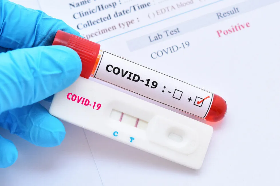 Quy định xét nghiệm Covid-19 tại Canada